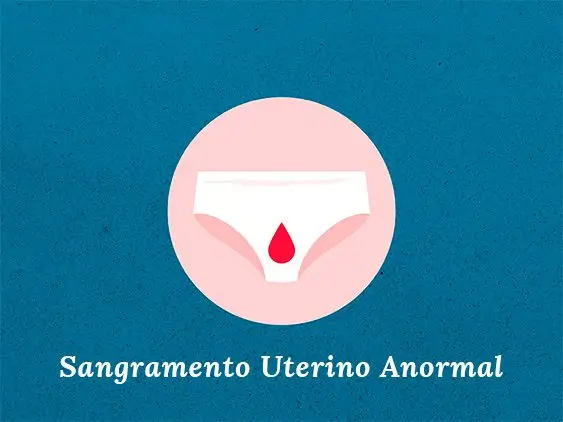 Sangramento Uterino Anormal