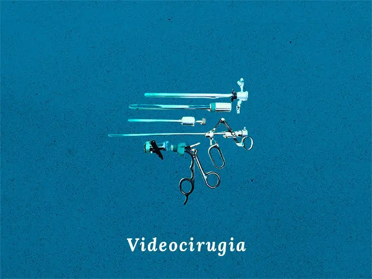 Videocirurgia